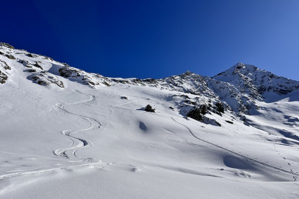 mal trägt es, mal nicht